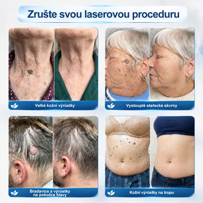 Oficiální značkový obchod |💚💚𝐏𝐢𝐜𝑑𝑜® 𝟩𝖽𝖾𝗻𝗻í 𝘰𝘥𝘴𝘵𝗋𝖺ň𝗈𝗏𝖺č 𝒔𝒌𝒗𝒓𝙣 𝙖 𝙥𝙞𝙜𝙢𝙚𝙣𝙩𝘰𝘷ý𝘤𝘩 𝘴𝘬𝖛𝖗𝖓 (Bezbolestný rollerball bez jizev)🎄