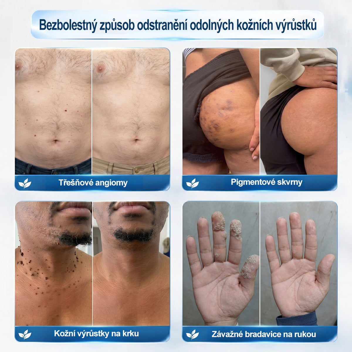 Oficiální značkový obchod |💚💚𝐏𝐢𝐜𝑑𝑜® 𝟩𝖽𝖾𝗻𝗻í 𝘰𝘥𝘴𝘵𝗋𝖺ň𝗈𝗏𝖺č 𝒔𝒌𝒗𝒓𝙣 𝙖 𝙥𝙞𝙜𝙢𝙚𝙣𝙩𝘰𝘷ý𝘤𝘩 𝘴𝘬𝖛𝖗𝖓 (Bezbolestný rollerball bez jizev)🎄