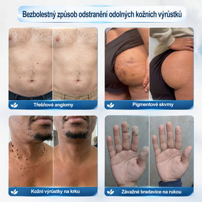 Oficiální značkový obchod |💚💚𝐏𝐢𝐜𝑑𝑜® 𝟩𝖽𝖾𝗻𝗻í 𝘰𝘥𝘴𝘵𝗋𝖺ň𝗈𝗏𝖺č 𝒔𝒌𝒗𝒓𝙣 𝙖 𝙥𝙞𝙜𝙢𝙚𝙣𝙩𝘰𝘷ý𝘤𝘩 𝘴𝘬𝖛𝖗𝖓 (Bezbolestný rollerball bez jizev)🎄